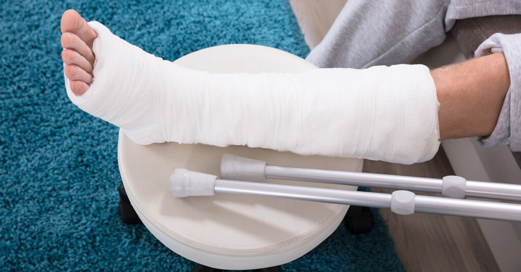 Post Fracture &Trauma